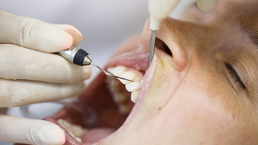 ZTK Untersuchung Zahnfleischentzündung